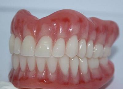 دندان مصنوعی و روش کاشت انواع آن